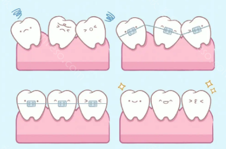台州市牙齿矫正的口腔医院名单,告诉你台州哪个牙科诊所好