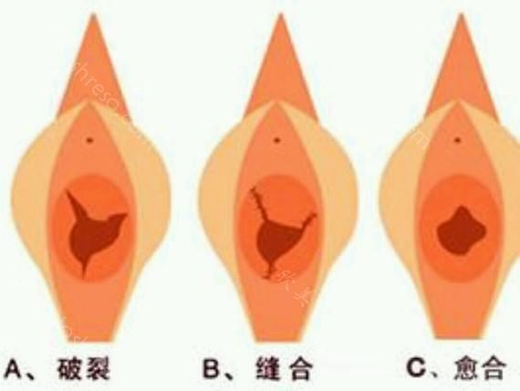 北京部队医院私密整形科2024价格表,附医生详细介绍