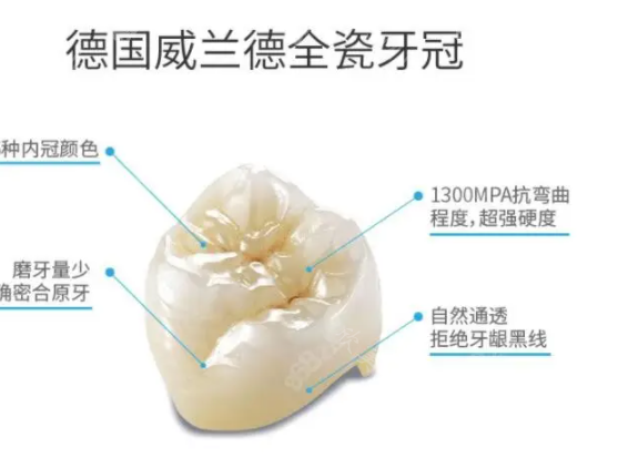 爱尔创全瓷牙价格1200是不是真的?全新情况分析