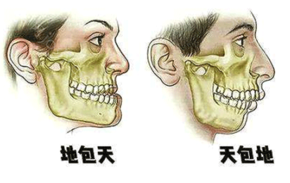 国内哪些医院有做正颌手术的资质?口碑医生推荐+价格表