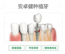 法国安卓健种植体好吗?与德国icx相比哪些不一样?