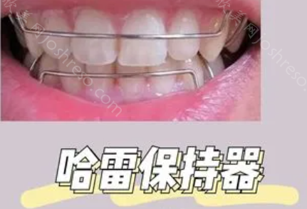 保持器戴了七八年还反弹?有什么补救办法吗?