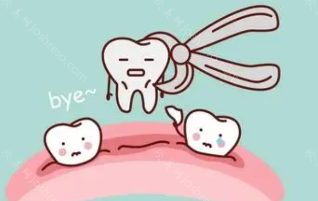 深圳拔牙一般多少钱一颗?2023价格表揭晓