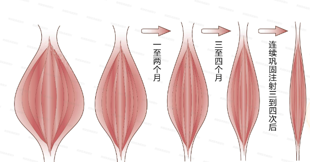 重庆时光整形除皱好多钱?50单位只需970元，价格真心便宜!