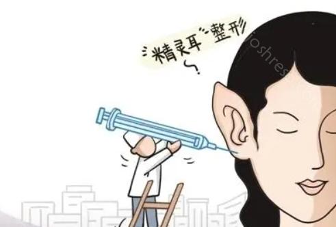 精灵耳到底是怎么做的?打玻尿酸的话需要打几支?