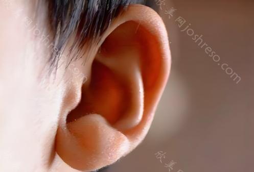 耳屏再造有哪些治疗方式?耳朵畸形治疗费用可以报销吗?