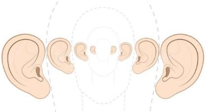 耳朵整形是什么原理?耳再造的具体步骤是怎样的?