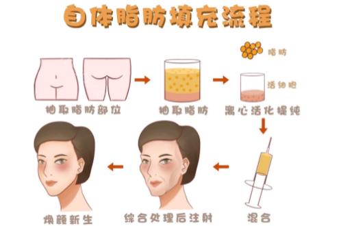 北京薇琳全新整形价格表整理：来看看北京薇琳做隆鼻、双眼皮要多少钱