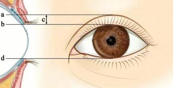 上海美莱吴海龙做眼睛效果如何?效果很好，做的双眼皮弧度特别自然