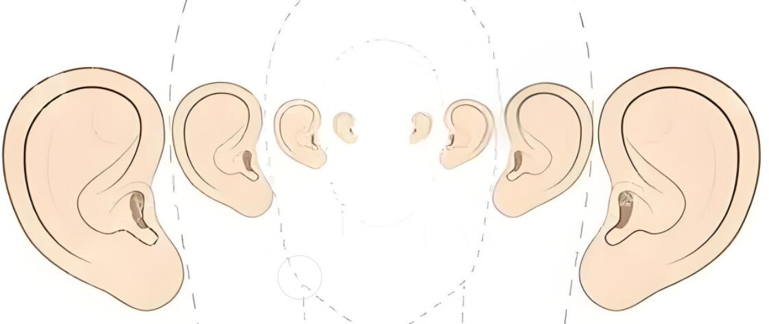 2024年成人耳朵整形手术费用一览