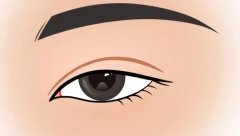 开眼角手术：小眼睛变大眼的逆袭之旅