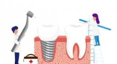 种植牙术后两年突发疼痛，可能原因及预防措施全解析