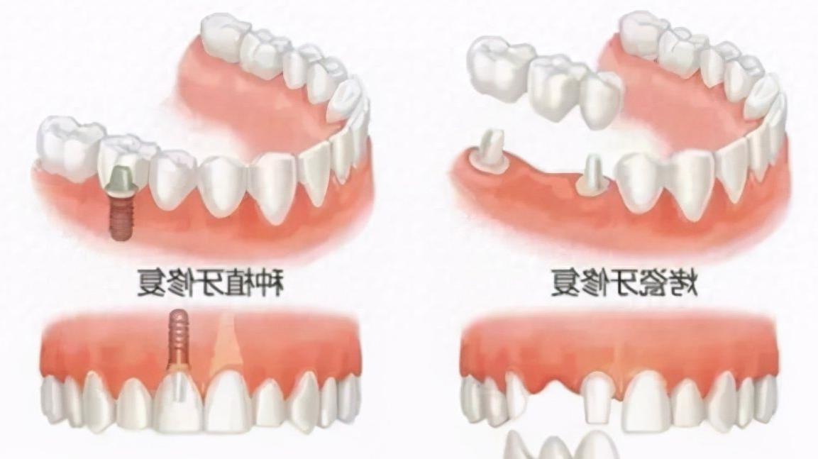 刷牙前，牙膏是否需要沾水呢？我们来探讨一下。