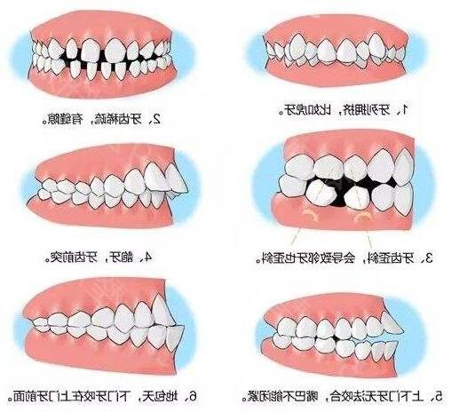 泉州安格尔口腔：2024年值得信赖的正规口腔医疗机构深度解析