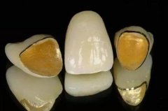 2024年鞍山牙齿矫正专家排行榜：专业技能与患者好评的融合