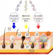 彩光嫩肤效果如何，效果维持时长及费用解析