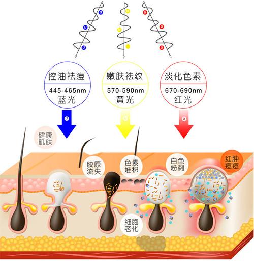 彩光嫩肤效果如何，效果维持时长及费用解析