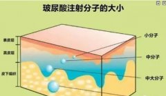 玻尿酸丰耳垂效果如何？费用多少？