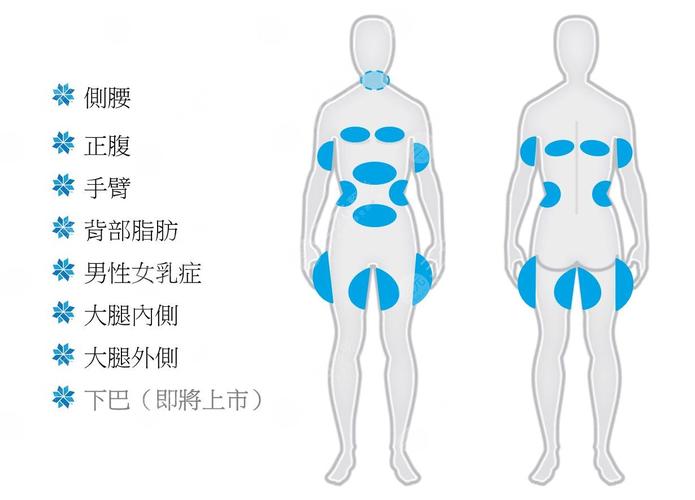 超脂塑减肥效果如何，费用多少？深入解析这一热门减肥技术