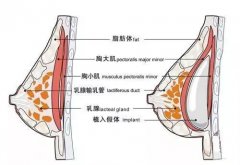 自体脂肪隆胸效果如何？费用多少？