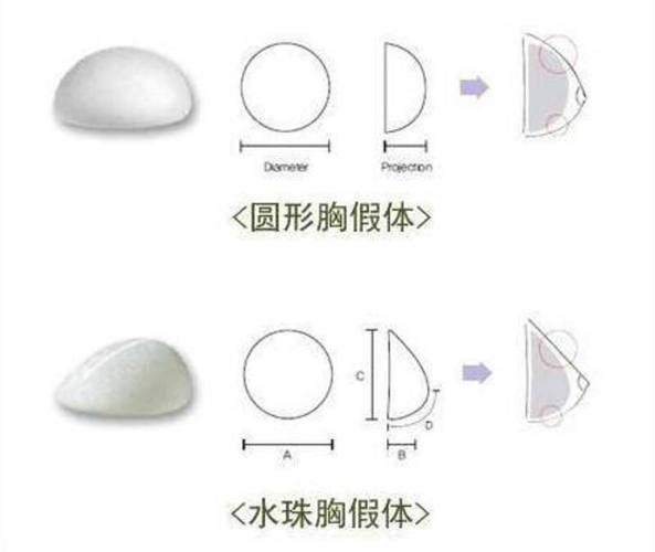 郑州华山整形医院丰胸效果及费用详解