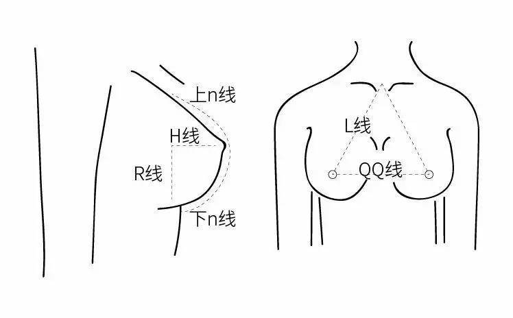 奥美定丰胸的潜在风险及取出费用解析