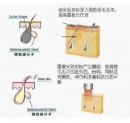 黑脸娃娃美容项目费用解析及选择指南