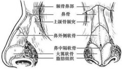 隆鼻术后不慎碰撞应如何处理