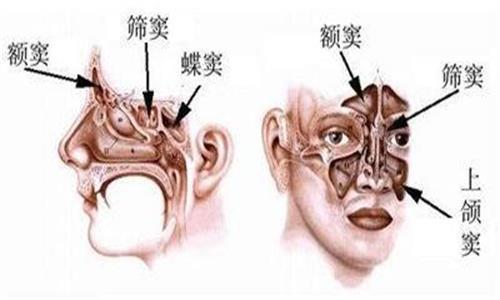 注射隆鼻术后可能遇到的问题及预防措施