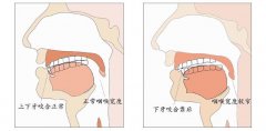 怎么样选择注射瘦脸和缩鼻头手术？费用多少？哪个效果好？