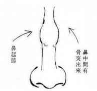 歪鼻矫正手术：怎么样选择医院和了解费用多少