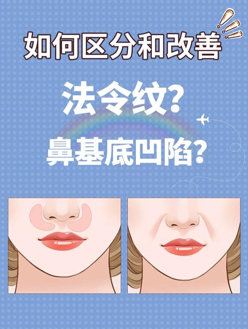 奥美定隆鼻效果如何？费用多少？