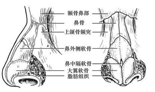 玻尿酸隆鼻效果如何及费用解析