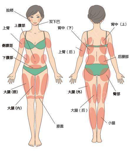 深圳吸脂减肥手术费用解析及效果评估