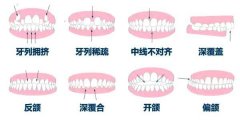 牙齿美白：价格与持久度的解析