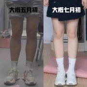 光纤溶脂瘦小腿效果如何？