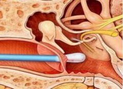 鼻子整形报价费用多少呢？项目收费价位【美鼻】