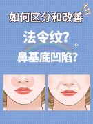 南京中大医院整形科价格表2025新发布！附医生介绍+隆鼻案例效果图~