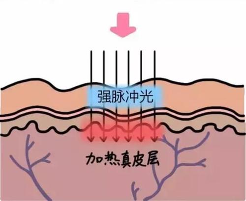 北京爱美丽医疗美容诊所怎么样？盘点医生、价格表、嫩肤案例分享！