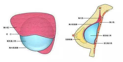 整形整容价钱汇总！包括双眼皮、隆鼻、隆胸~