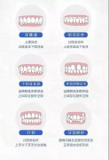 牙齿有虫洞怎么办？有虫洞不疼需要补牙吗？补牙的注意事项有什么？