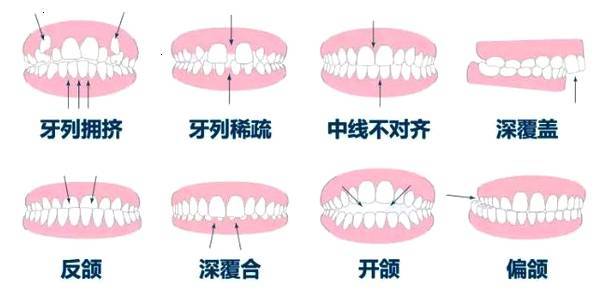 优雅联合广州口腔门诊收费价目表，牙医名单、牙齿矫正案例