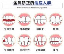 2025济南口腔医院整牙价格表更新，附医生介绍+牙齿矫正案例