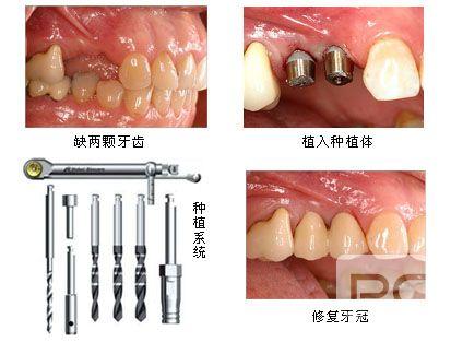 深圳陈静口腔诊所价格多少？贵吗？附收费价目表