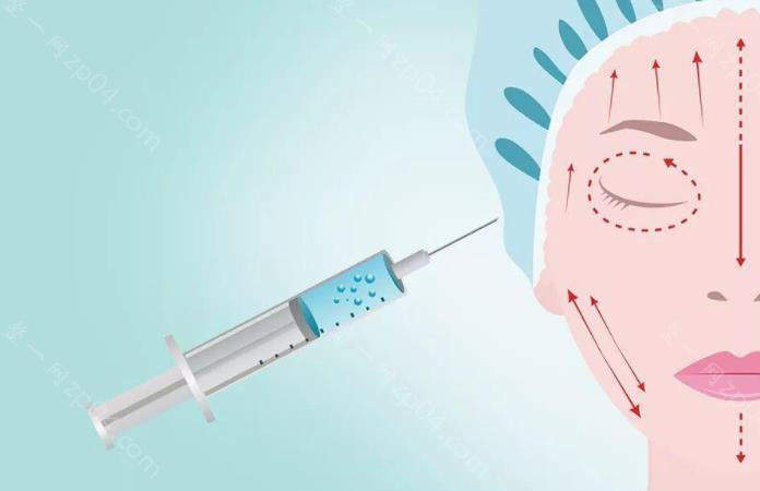 自体脂肪注射除皱价格一般是多少？受哪些因素影响会产生变化？