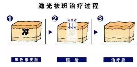 南宁市第二人民医院整形科2024年费用一览表